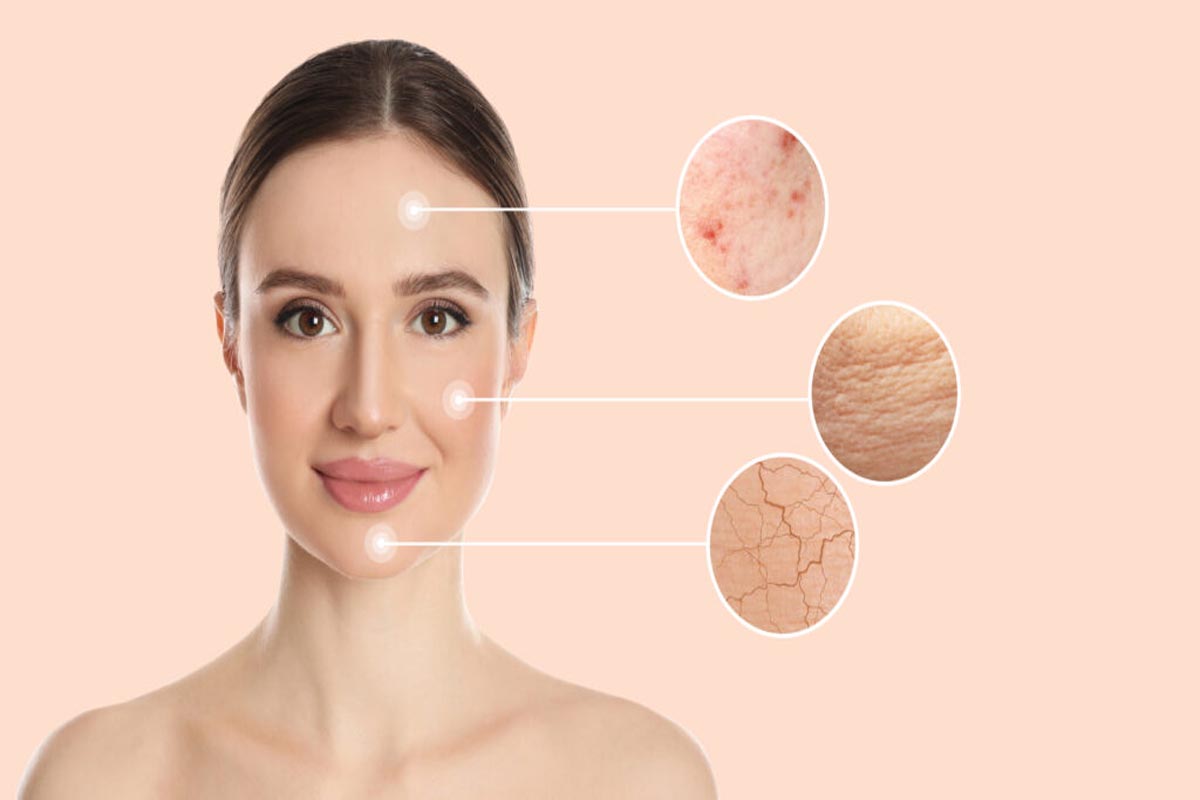 شناخت نوع پوست اولین قدم؛ برای داشتن پوستی سالم